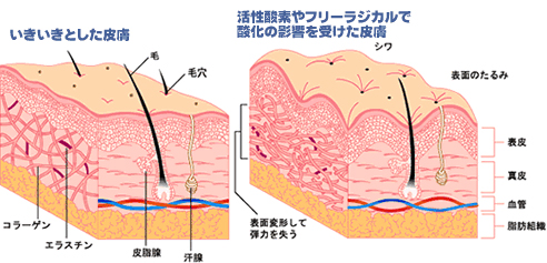 いきいきとした皮膚／活性酸素やフリーラジカルで参加の影響を受けた皮膚