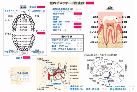 歯のブロッケード詳細図