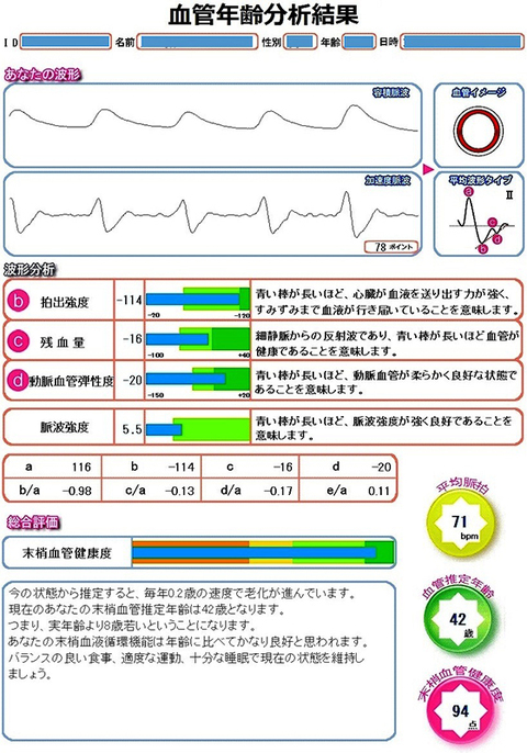 自律神経測定器 TAS9 VIEW（タスナインビュー）