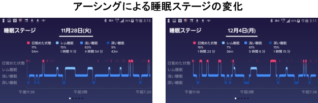 アーシングによる睡眠ステージの変化