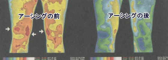 アーシングの効果「赤外線-痛みとコリ炎症」