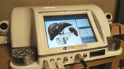 波動測定器レヨコンプPS1000ポラーの肝臓分析