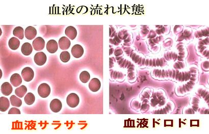 血液の流れの比較